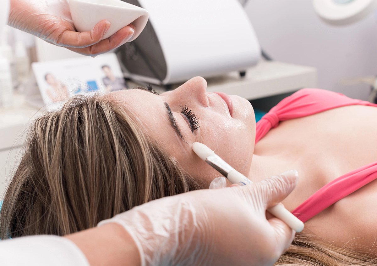 Chemical Peel Benefits: What They Do for Your Skin